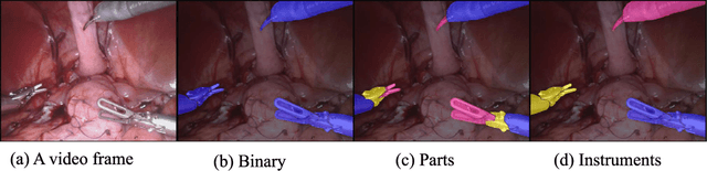 Figure 1 for Real-Time Instrument Segmentation in Robotic Surgery using Auxiliary Supervised Deep Adversarial Learning