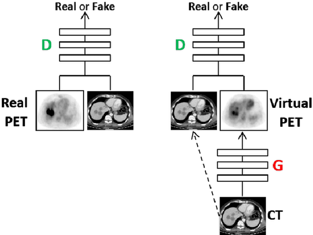 Figure 3 for Cross-Modality Synthesis from CT to PET using FCN and GAN Networks for Improved Automated Lesion Detection
