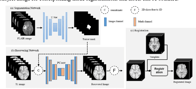 Figure 1 for Automatic Segmentation of Non-Tumor Tissues in Glioma MR Brain Images Using Deformable Registration with Partial Convolutional Networks