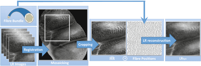 Figure 1 for Effective deep learning training for single-image super-resolution in endomicroscopy exploiting video-registration-based reconstruction