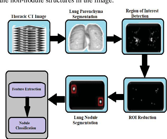 Figure 3 for Early Diagnosis of Lung Cancer Using Computer Aided Detection via Lung Segmentation Approach