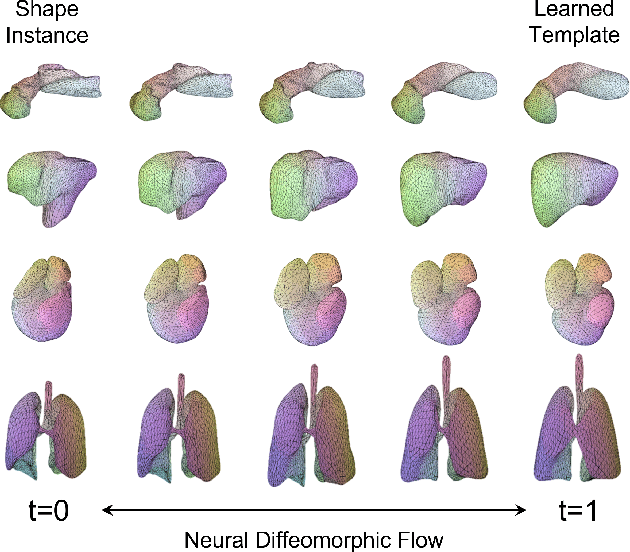 Figure 1 for Topology-Preserving Shape Reconstruction and Registration via Neural Diffeomorphic Flow