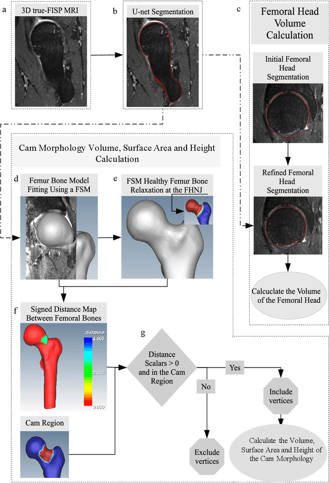 Figure 1 for Automated volumetric and statistical shape assessment of cam-type morphology of the femoral head-neck region from 3D magnetic resonance images