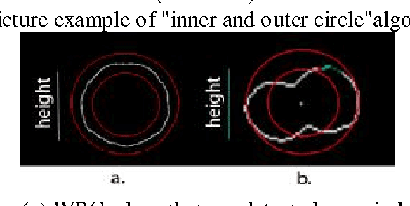 Figure 2 for Identification and Counting White Blood Cells and Red Blood Cells using Image Processing Case Study of Leukemia