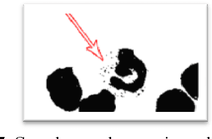 Figure 4 for Identification and Counting White Blood Cells and Red Blood Cells using Image Processing Case Study of Leukemia