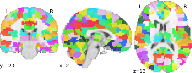 Figure 2 for Multi-site Diagnostic Classification Of Schizophrenia Using 3D CNN On Aggregated Task-based fMRI Data