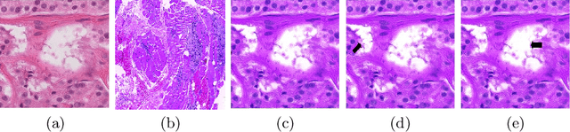 Figure 3 for Structure Preserving Stain Normalization of Histopathology Images Using Self-Supervised Semantic Guidance