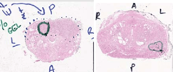 Figure 1 for Ink removal from histopathology whole slide images by combining classification, detection and image generation models