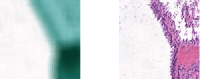 Figure 3 for Ink removal from histopathology whole slide images by combining classification, detection and image generation models