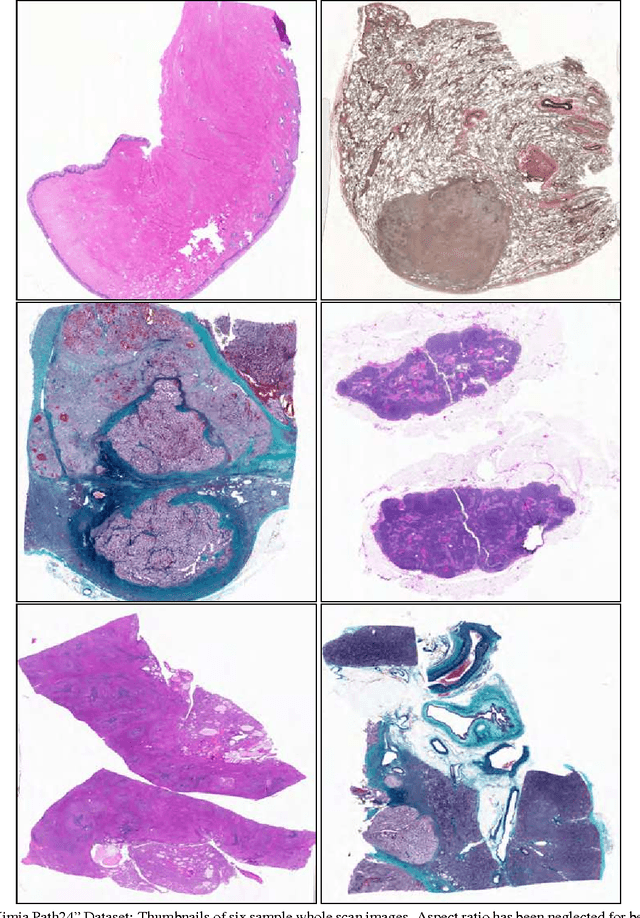 Figure 1 for Classification and Retrieval of Digital Pathology Scans: A New Dataset