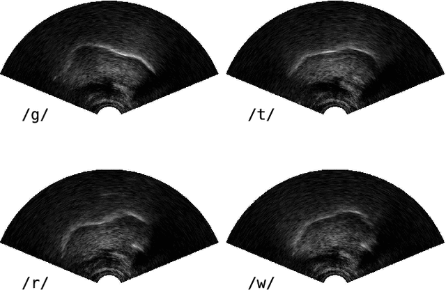 Figure 2 for Exploiting ultrasound tongue imaging for the automatic detection of speech articulation errors