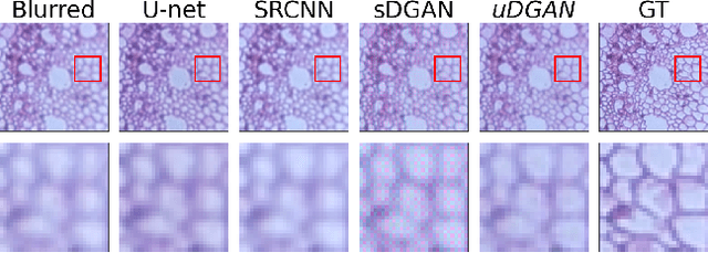 Figure 4 for MMDF: Mobile Microscopy Deep Framework