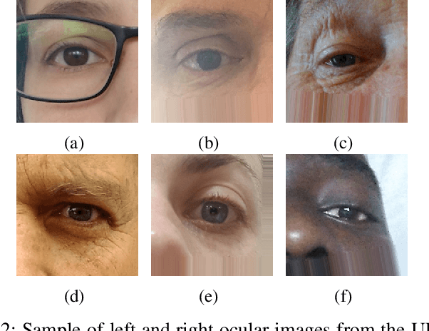 Figure 2 for Investigating Fairness of Ocular Biometrics Among Young, Middle-Aged, and Older Adults