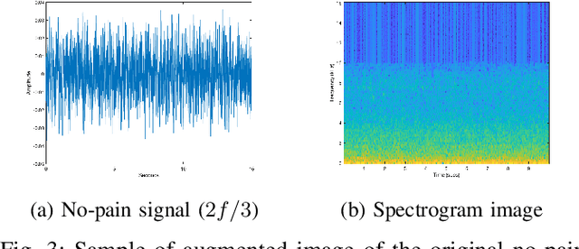 Figure 3 for Harnessing the Power of Deep Learning Methods in Healthcare: Neonatal Pain Assessment from Crying Sound