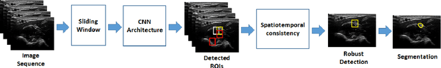 Figure 1 for Deep learning with spatiotemporal consistency for nerve segmentation in ultrasound images