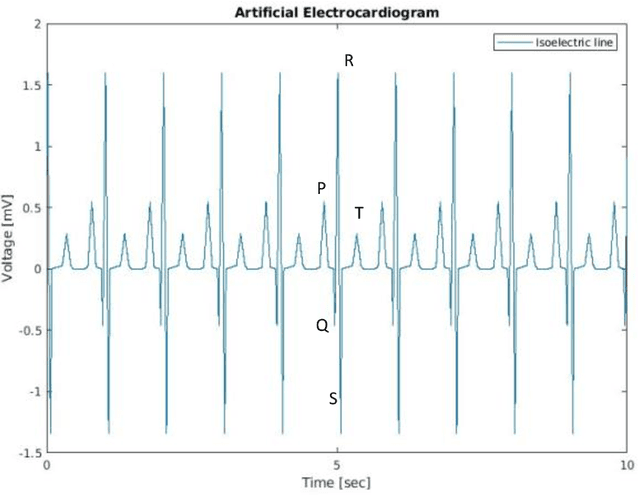 Figure 1 for Complex Deep Learning Models for Denoising of Human Heart ECG signals