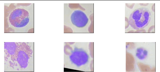 Figure 1 for Illuminated Decision Trees with Lucid