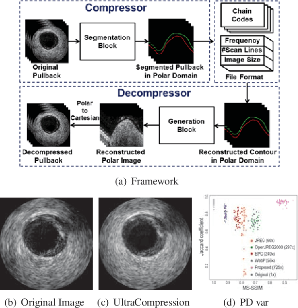 Figure 1 for UltraCompression: Framework for High Density Compression of Ultrasound Volumes using Physics Modeling Deep Neural Networks