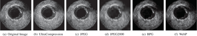 Figure 4 for UltraCompression: Framework for High Density Compression of Ultrasound Volumes using Physics Modeling Deep Neural Networks