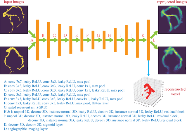 Figure 2 for Weakly-supervised 3D coronary artery reconstruction from two-view angiographic images