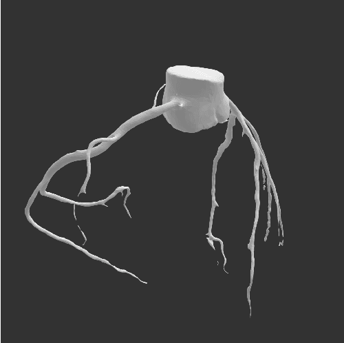 Figure 4 for Weakly-supervised 3D coronary artery reconstruction from two-view angiographic images