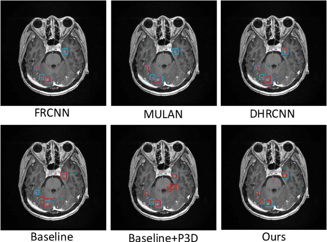 Figure 3 for View-Disentangled Transformer for Brain Lesion Detection