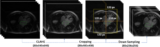 Figure 3 for Dilated Convolutions in Neural Networks for Left Atrial Segmentation in 3D Gadolinium Enhanced-MRI