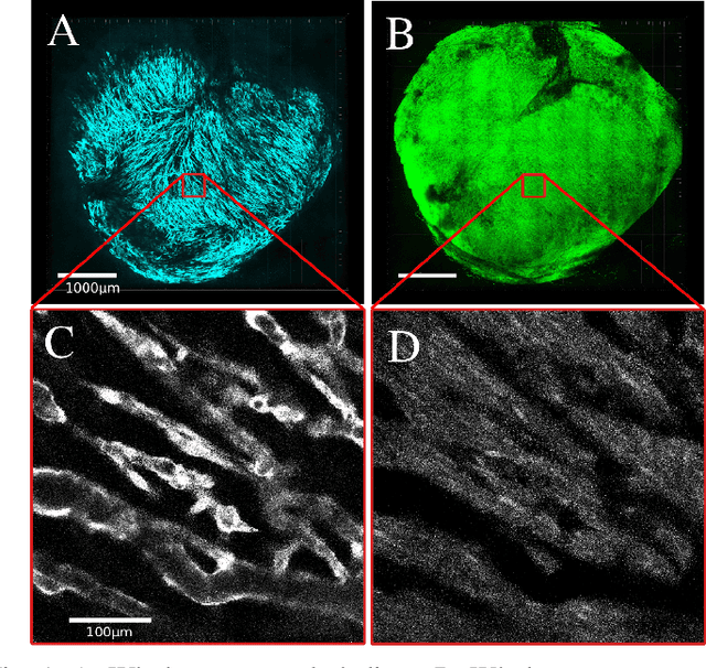 Figure 1 for Extracting 3D Vascular Structures from Microscopy Images using Convolutional Recurrent Networks