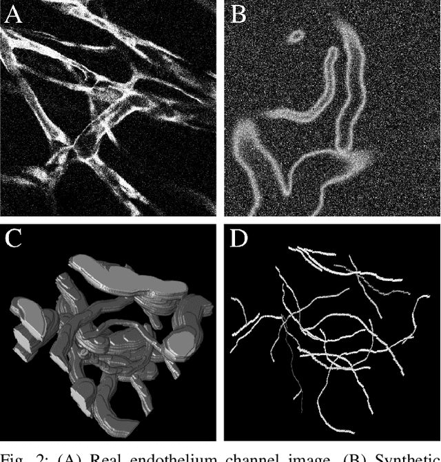 Figure 2 for Extracting 3D Vascular Structures from Microscopy Images using Convolutional Recurrent Networks