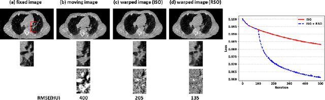 Figure 4 for Region Specific Optimization (RSO)-based Deep Interactive Registration