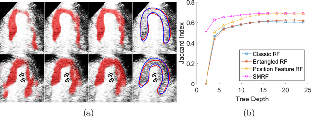 Figure 3 for Myocardial Segmentation of Contrast Echocardiograms Using Random Forests Guided by Shape Model