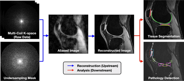Figure 1 for SKM-TEA: A Dataset for Accelerated MRI Reconstruction with Dense Image Labels for Quantitative Clinical Evaluation