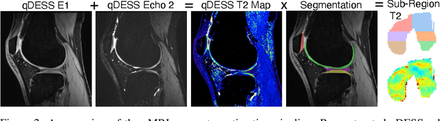 Figure 3 for SKM-TEA: A Dataset for Accelerated MRI Reconstruction with Dense Image Labels for Quantitative Clinical Evaluation