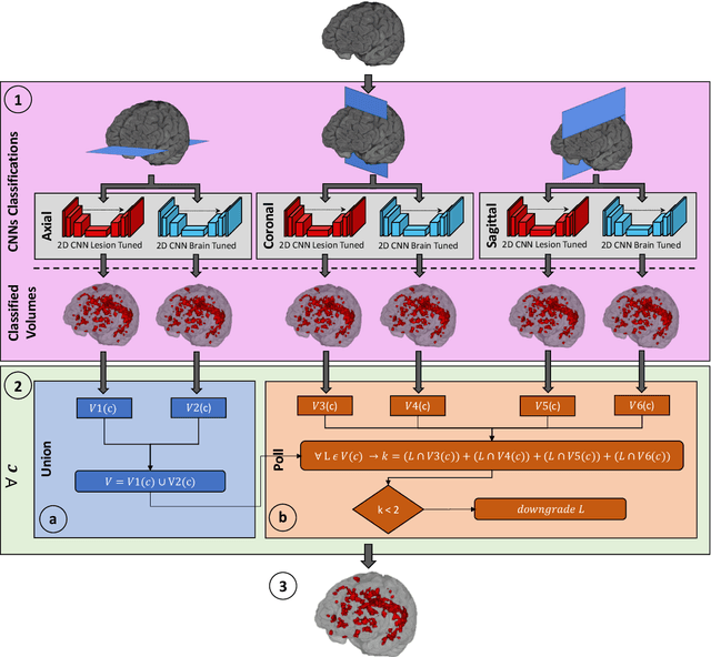 Figure 1 for Multiple Sclerosis Lesions Identification/Segmentation in Magnetic Resonance Imaging using Ensemble CNN and Uncertainty Classification