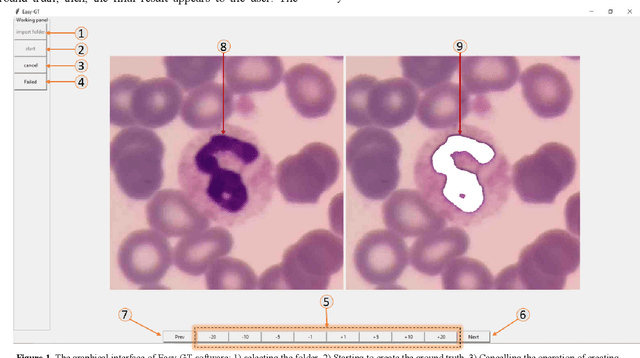 Figure 1 for Easy-GT: Open-Source Software to Facilitate Making the Ground Truth for White Blood Cells Nucleus