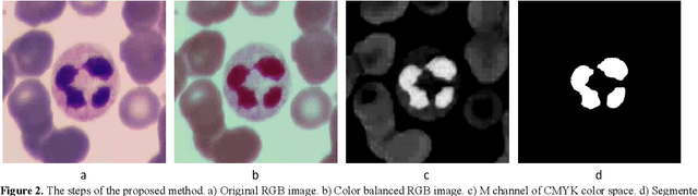 Figure 3 for Easy-GT: Open-Source Software to Facilitate Making the Ground Truth for White Blood Cells Nucleus