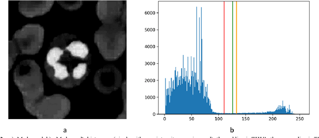 Figure 4 for Easy-GT: Open-Source Software to Facilitate Making the Ground Truth for White Blood Cells Nucleus