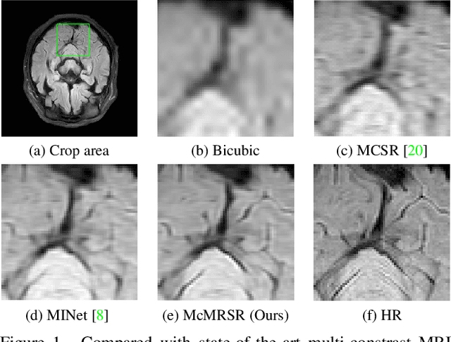 Figure 1 for Transformer-empowered Multi-scale Contextual Matching and Aggregation for Multi-contrast MRI Super-resolution