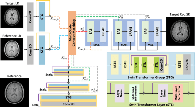 Figure 3 for Transformer-empowered Multi-scale Contextual Matching and Aggregation for Multi-contrast MRI Super-resolution