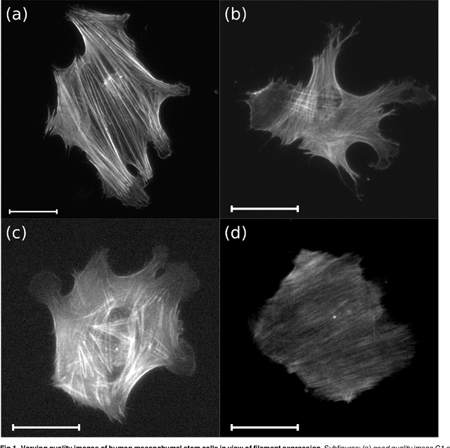 Figure 1 for The Filament Sensor for Near Real-Time Detection of Cytoskeletal Fiber Structures