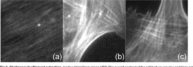 Figure 3 for The Filament Sensor for Near Real-Time Detection of Cytoskeletal Fiber Structures