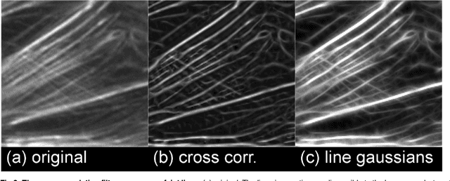 Figure 4 for The Filament Sensor for Near Real-Time Detection of Cytoskeletal Fiber Structures