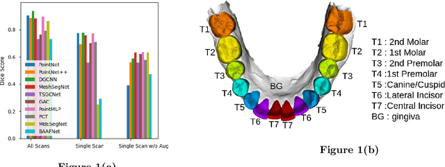 Figure 1 for Automatic Tooth Segmentation from 3D Dental Model using Deep Learning: A Quantitative Analysis of what can be learnt from a Single 3D Dental Model