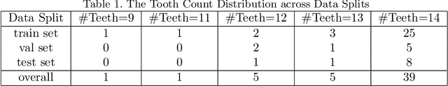 Figure 2 for Automatic Tooth Segmentation from 3D Dental Model using Deep Learning: A Quantitative Analysis of what can be learnt from a Single 3D Dental Model