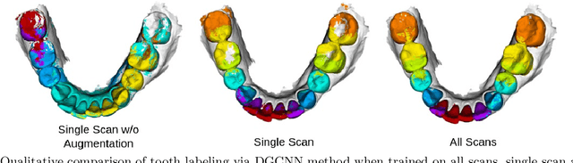 Figure 4 for Automatic Tooth Segmentation from 3D Dental Model using Deep Learning: A Quantitative Analysis of what can be learnt from a Single 3D Dental Model
