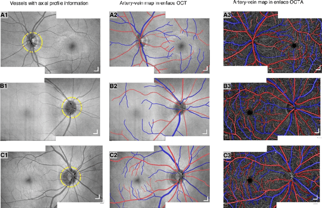 Figure 4 for Depth-resolved vascular profile features for artery-vein classification in OCT and OCT angiography of human retina