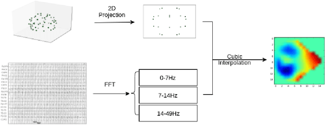 Figure 2 for Learning Robust Features using Deep Learning for Automatic Seizure Detection