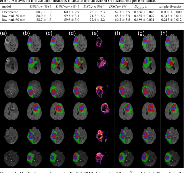 Figure 4 for Stochastic Segmentation Networks: Modelling Spatially Correlated Aleatoric Uncertainty