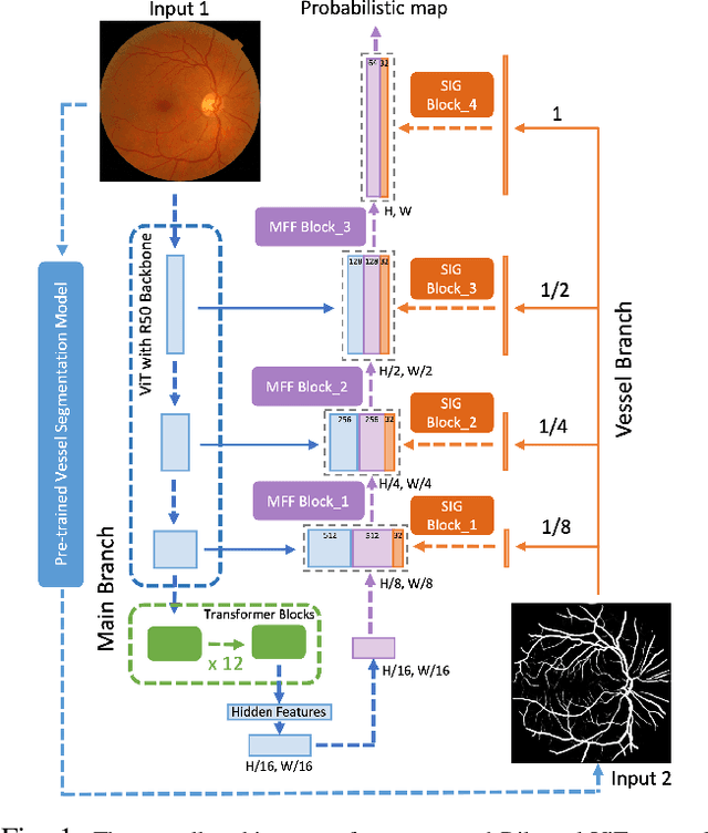 Figure 1 for Bilateral-ViT for Robust Fovea Localization