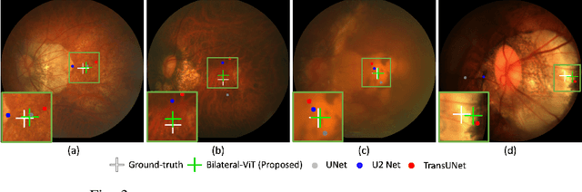 Figure 3 for Bilateral-ViT for Robust Fovea Localization